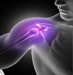 Illustration of shoulder pain