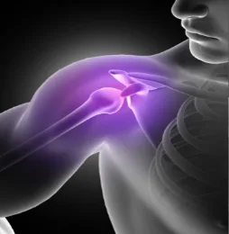 Illustration of shoulder pain